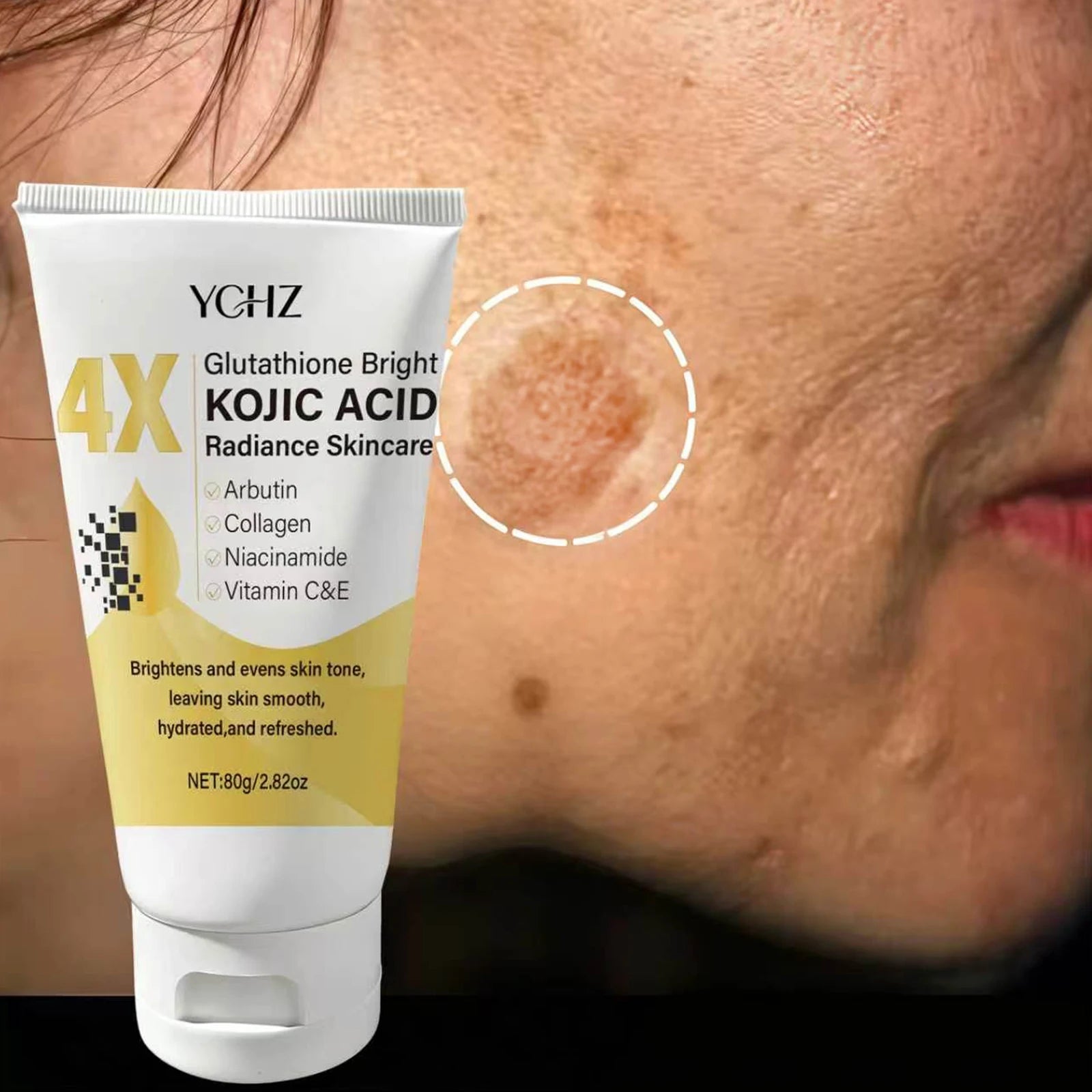 Kojic Acid Brightening Face Cream — Even Skin Tone, Fade Dark Spots & Moisturise Day & Night