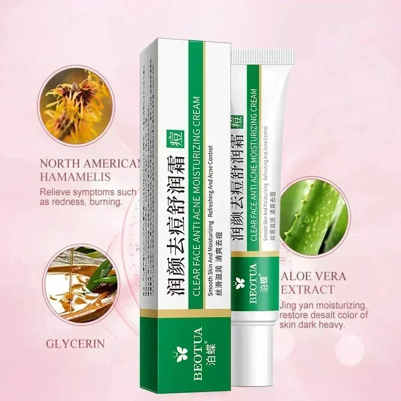 Herbal Acne Treatment Cream — Scar Repair, Blackhead Remover & Pore Minimiser
